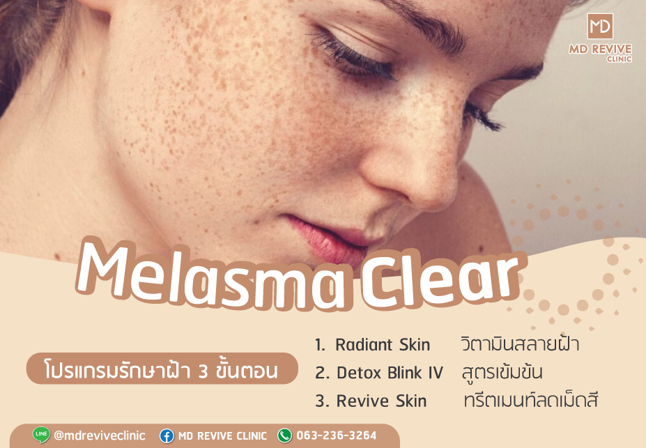 Melasma Clear โปรแกรมรักษาฝ้า 3 ขั้นตอน